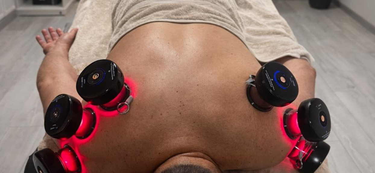 Cupping Therapy - Long - (45 minutes) - Litkov Recovery Systems